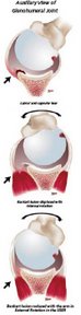 auxiliary view of glenohumeral joint
