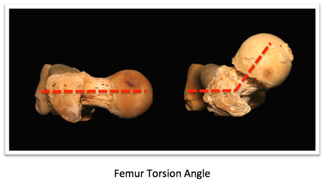 Femur Torsion Variations