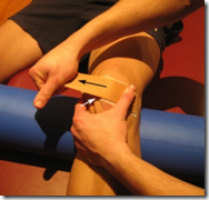 patellar taping