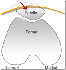 patellar tape