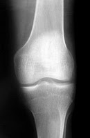 knee x-ray