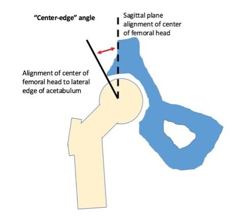 hip anatomy squat