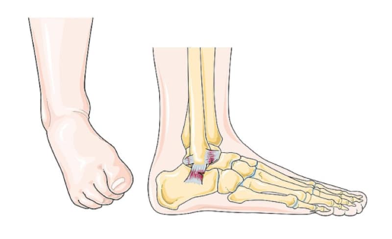 Make ankle Mobility a Part of your Daily Routine, especially if