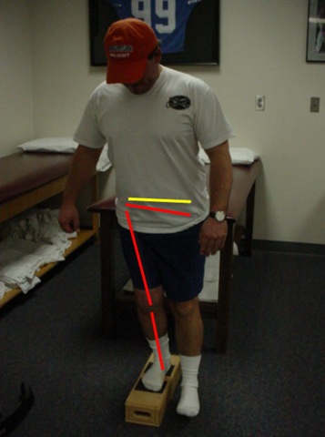 Assessing and Treating Dysfunction of the Gluteus Medius