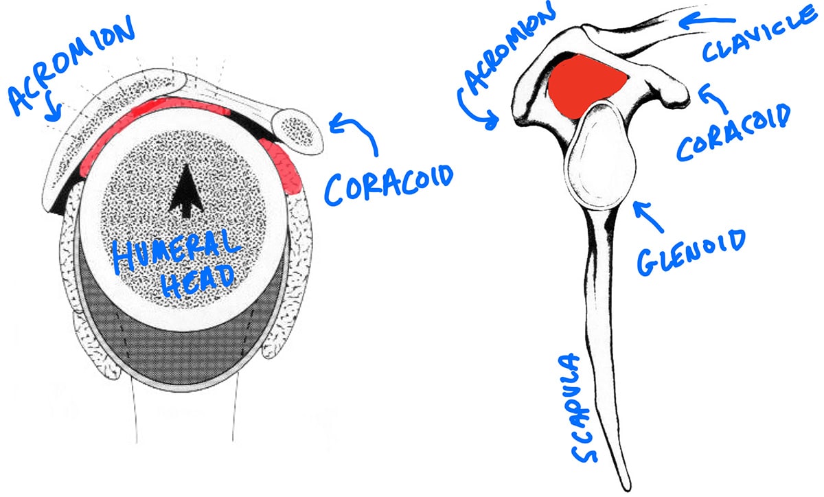 shoulder-impingement-3-keys-to-the-evaluation-and-treatment-mike